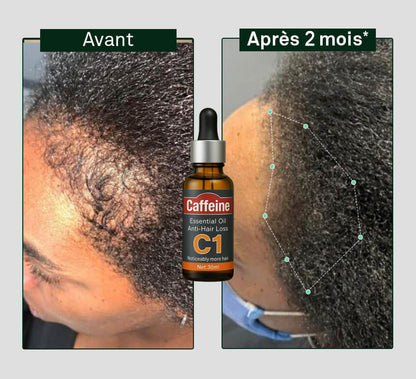 Huile à la Cafféine C1 contre la chute de cheveux