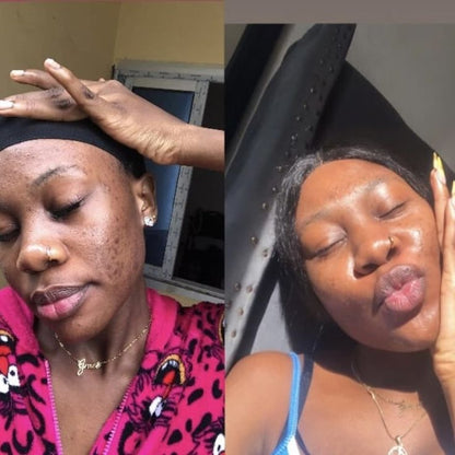 Pack de 3 Savons Kojic –Purifie, Nettoie et Illumine Visiblement la Peau