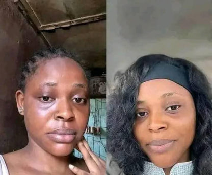 Savon Kojie San : Éclat Naturel, Peau Nette, Fraîche & Éclatante