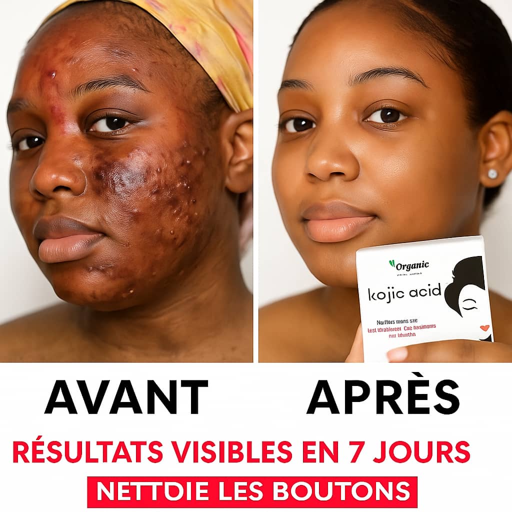 Savon Kojie San : Éclat Naturel, Peau Nette, Fraîche & Éclatante