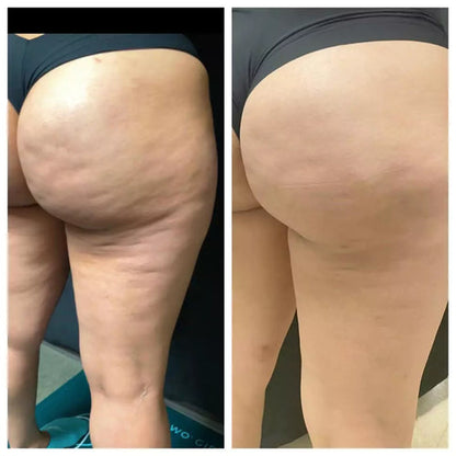Patch BeautyShan : Ventre Plat-Anti-cellulite